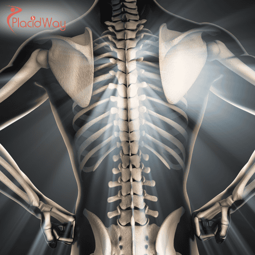 Bone Marrow Stem Cell Therapy in Turkey: Affordable Option for Australian Patients